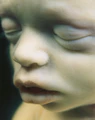 Fetus klein 2