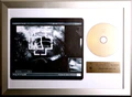 Thumbnail for version as of 05:10, 12 January 2025
